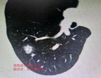 查看图片需登陆