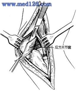 查看图片需登陆