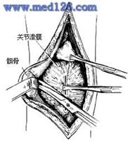 查看图片需登陆