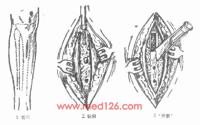 查看图片需登陆