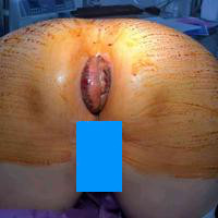 查看图片需登陆