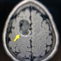 查看图片需登陆