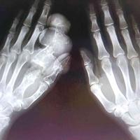 查看图片需登陆