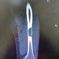 查看图片需登陆