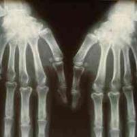 查看图片需登陆