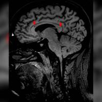 查看图片需登陆