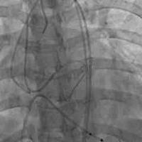 查看图片需登陆