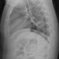 查看图片需登陆