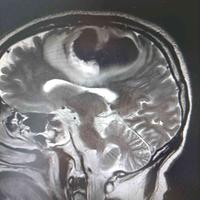 查看图片需登陆